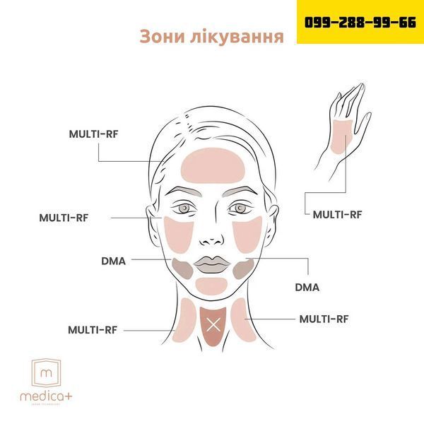 МИКРОТОКОВЫЙ RF ЛИФТИНГ МАССАЖЕР ДЛЯ ЛИЦА MEDICA+ SKIN LIFTING 7.0 WHITE (EMS+LED) (ЯПОНИЯ) 🇯🇵Medica+ ПОСТОЯННАЯ СКИДКА 20% в подарок🎁 27 фото