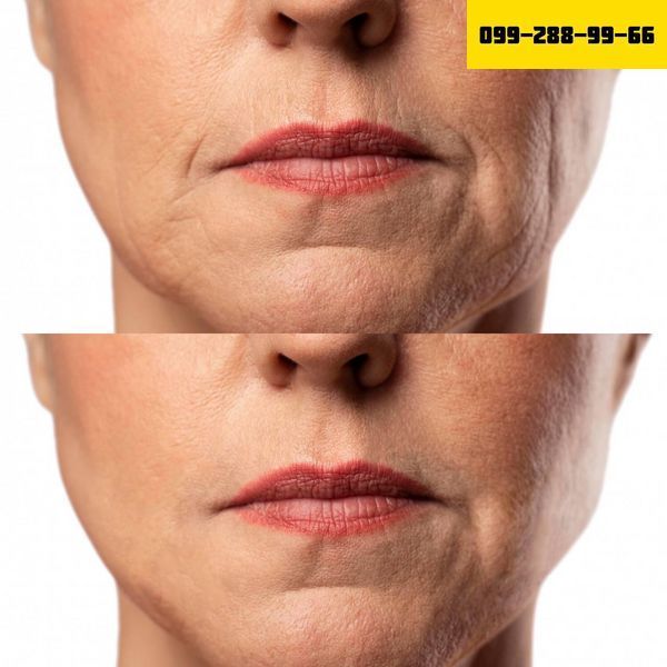 МИКРОТОКОВЫЙ RF ЛИФТИНГ МАССАЖЕР ДЛЯ ЛИЦА MEDICA+ SKIN LIFTING 7.0 WHITE (EMS+LED) (ЯПОНИЯ) 🇯🇵Medica+ ПОСТОЯННАЯ СКИДКА 20% в подарок🎁 27 фото