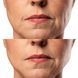 МИКРОТОКОВЫЙ RF ЛИФТИНГ МАССАЖЕР ДЛЯ ЛИЦА MEDICA+ SKIN LIFTING 7.0 WHITE (EMS+LED) (ЯПОНИЯ) 🇯🇵Medica+ ПОСТОЯННАЯ СКИДКА 20% в подарок🎁 27 фото 7