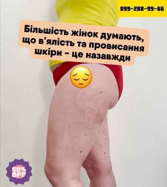 Антицеллюлитный скраб Meccano-скраб Робьюти 55777777 фото