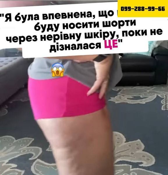 Антицеллюлитный скраб Meccano-скраб Робьюти 55777777 фото