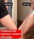 Антицеллюлитный скраб Meccano-скраб Робьюти 55777777 фото 5