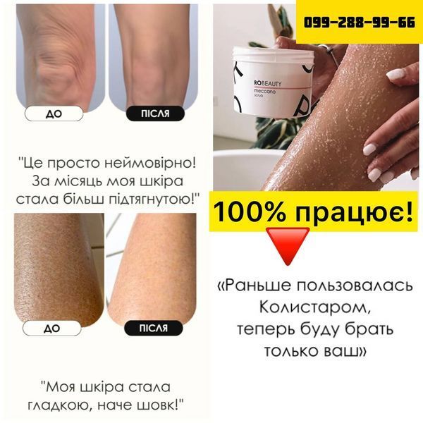 Антицелюлітний скраб 100% працює, чи ми повертаємо гроші! Meccano-скраб (650мл) 4343434 фото