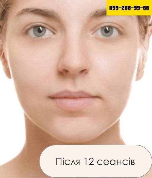 КОКОСовий скраб для обличчя - ЗМЕНШУЄ ВИДИМІСТЬ ТОНКИХ ЗМОРШОК!!! 6766665 фото