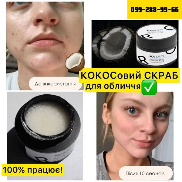 КОКОСовий скраб для обличчя - ЗМЕНШУЄ ВИДИМІСТЬ ТОНКИХ ЗМОРШОК!!! 6766665 фото