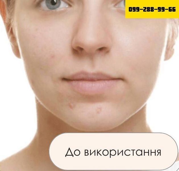 КОКОСовий скраб для обличчя - ЗМЕНШУЄ ВИДИМІСТЬ ТОНКИХ ЗМОРШОК!!! 6766665 фото